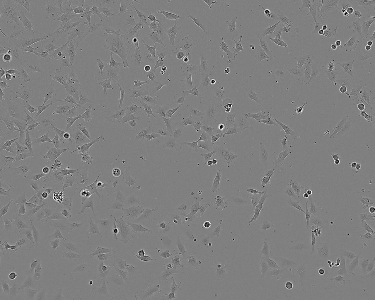 小鼠卵巢颗粒细胞形态图片