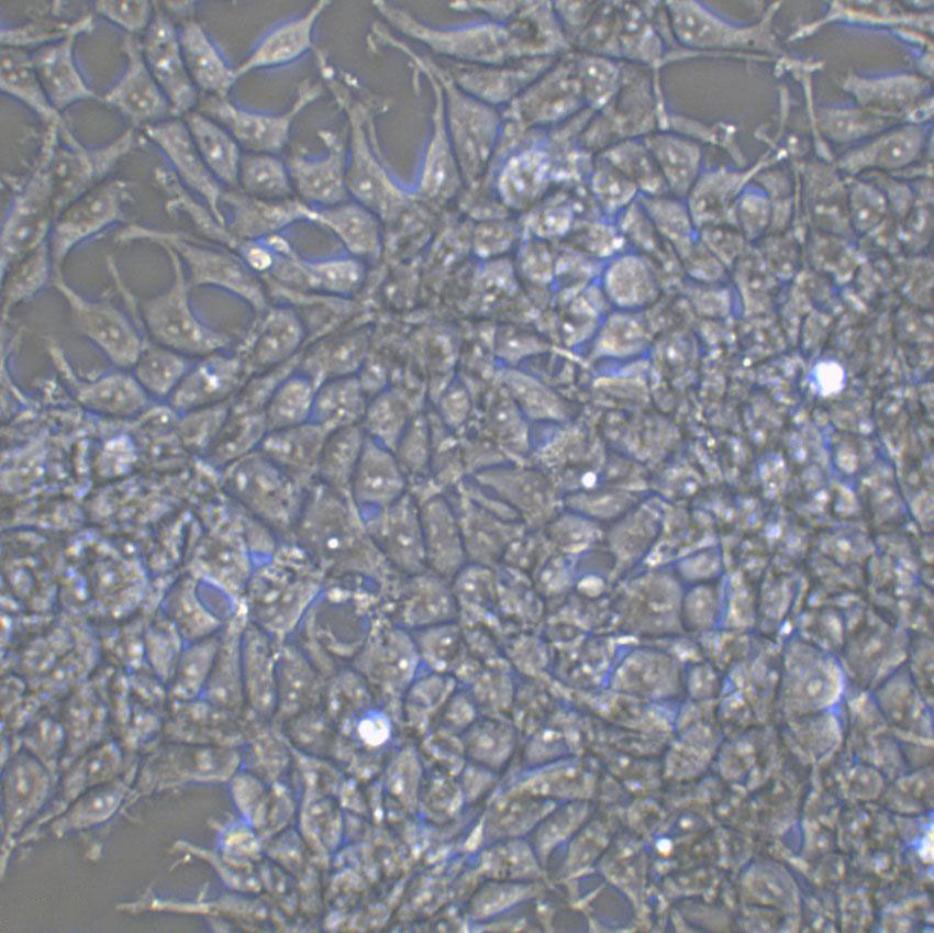 UMC-11 epithelioid cells人肺良性肿瘤细胞系,UMC-11 epithelioid cells