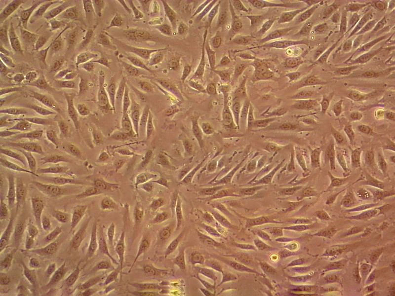 BALB/3T3 clone A31 fibroblast cells小鼠胚胎成纤维细胞系,BALB/3T3 clone A31 fibroblast cells