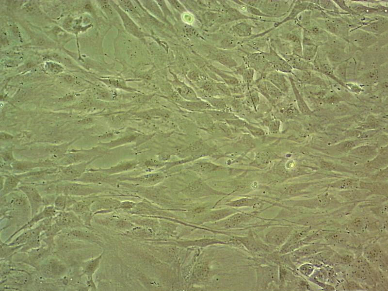 WML2 fibroblast cells小鼠肺成纤维细胞系,WML2 fibroblast cells