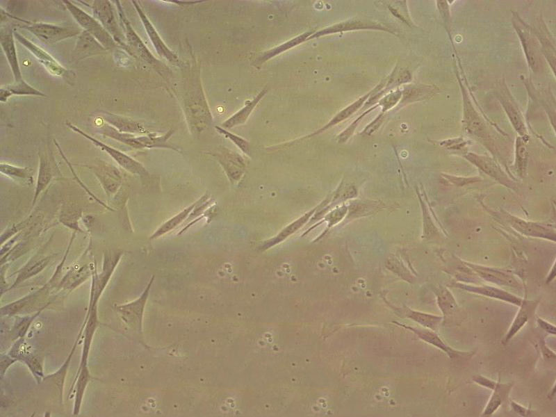 CCD-33Co fibroblast cells人结肠成纤维细胞系,CCD-33Co fibroblast cells