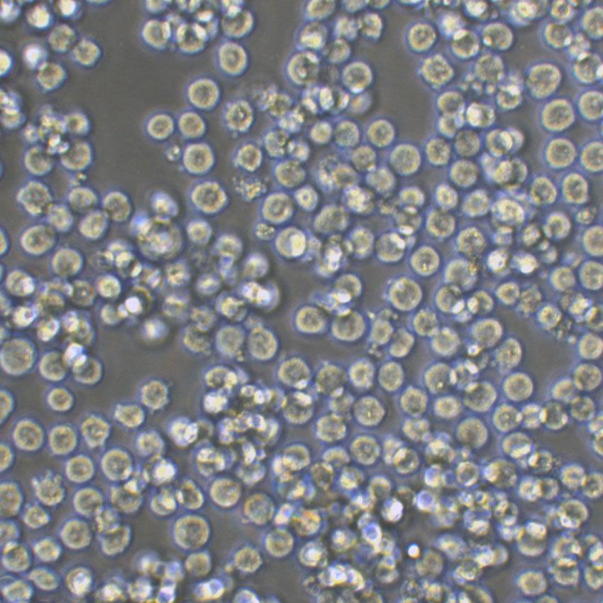 MOLT-4 Lymphoblastoid cells人急性淋巴母细胞性白血病细胞系,MOLT-4 Lymphoblastoid cells