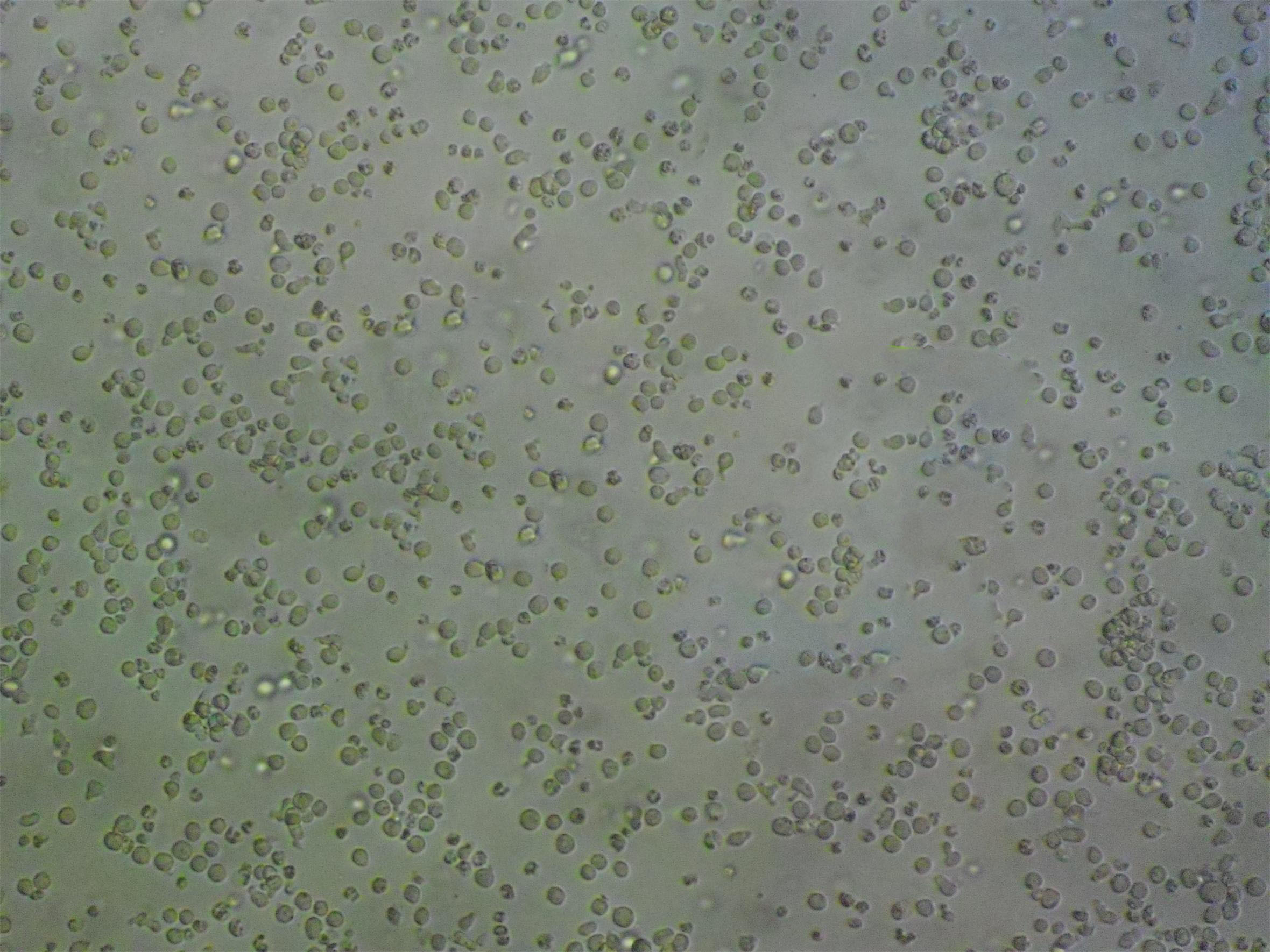 ANA-1 Lymphoblastoid cells小鼠巨噬细胞系,ANA-1 Lymphoblastoid cells