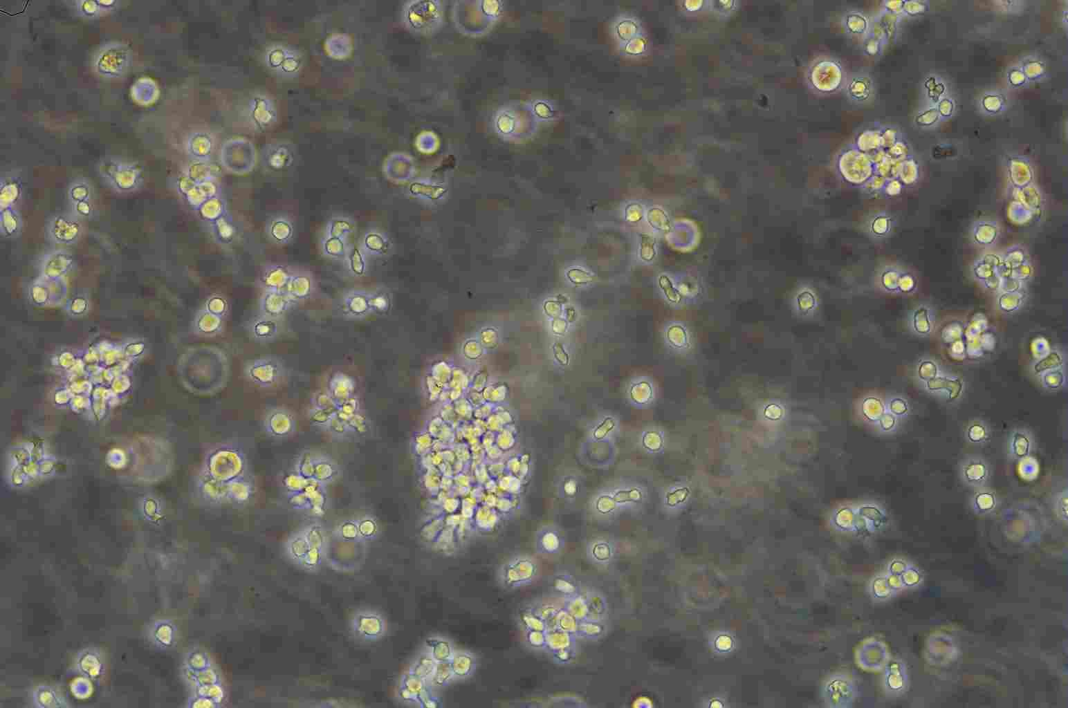 EL4 Lymphoblastoid cellsEL4小鼠淋巴瘤细胞系,EL4 Lymphoblastoid cells