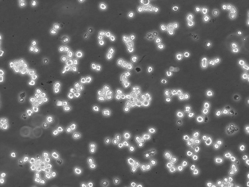 BCP-1 Lymphoblastoid cells人B淋巴细胞瘤细胞系,BCP-1 Lymphoblastoid cells