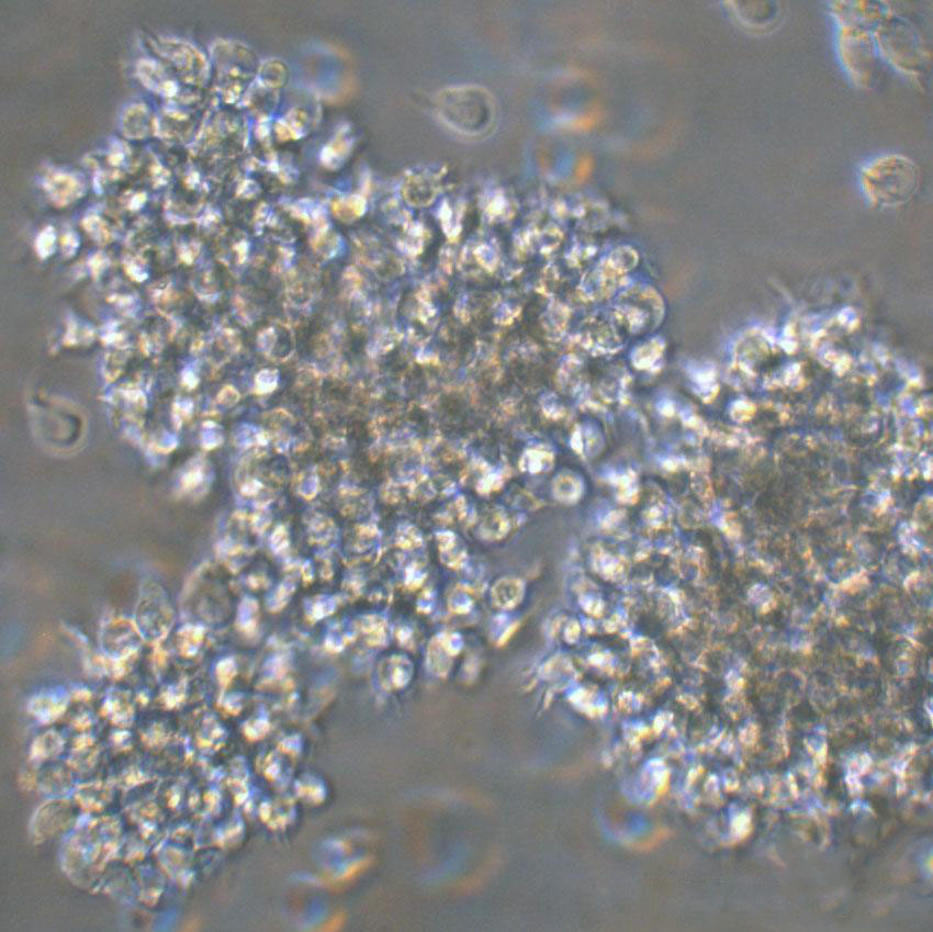 Toledo Lymphoblastoid cells人皮肤T淋巴细胞瘤细胞系,Toledo Lymphoblastoid cells