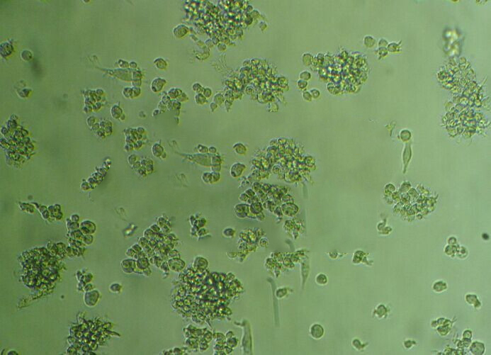 REC-1 Lymphoblastoid cells人淋巴瘤细胞系,REC-1 Lymphoblastoid cells