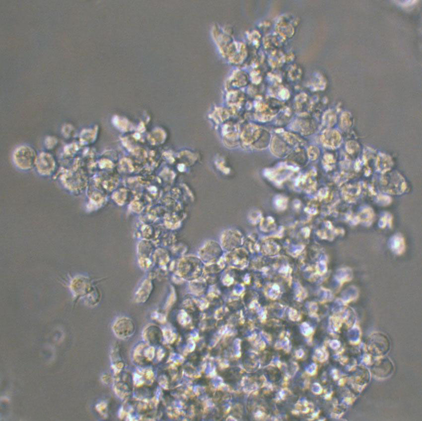Karpas-422 Lymphoblastoid cells人类B细胞淋巴瘤细胞系,Karpas-422 Lymphoblastoid cells