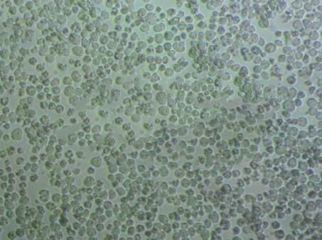 MLMA Lymphoblastoid cells人恶性淋巴瘤细胞系,MLMA Lymphoblastoid cells