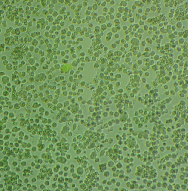 Z-138 Lymphoblastoid cells人套细胞淋巴瘤细胞系,Z-138 Lymphoblastoid cells