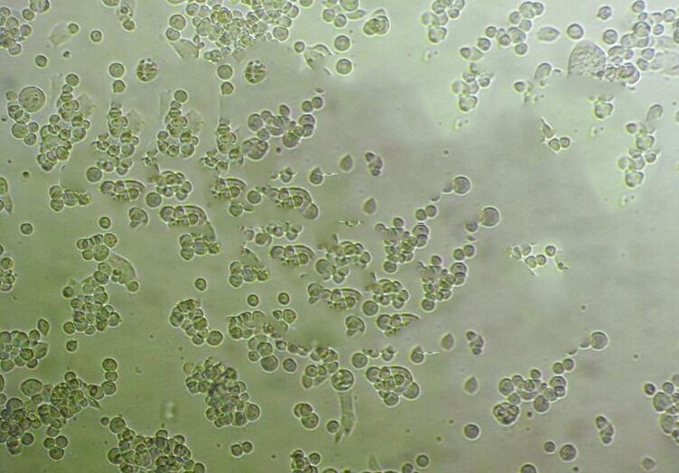 A3 Lymphoblastoid cells人T淋巴细胞白血病细胞系,A3 Lymphoblastoid cells