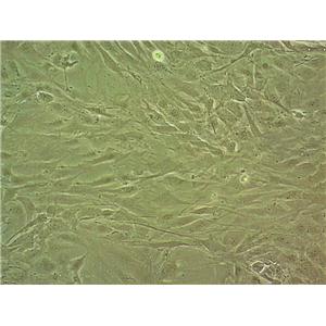 RASMC fibroblast cells大鼠主动脉平滑肌细胞系