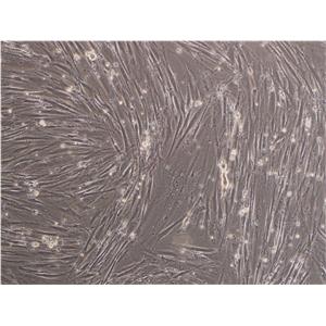 GM00637 fibroblast cells人皮肤成纤维细胞系