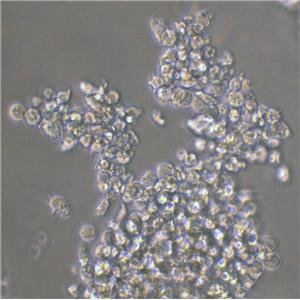 CA46 Lymphoblastoid cells人burkitt淋巴瘤细胞系