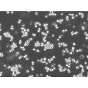 Kasumi-1 Lymphoblastoid cells人红白血病细胞系