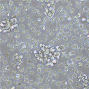 SU-DHL-4 Lymphoblastoid cells人弥漫性组织淋巴瘤细胞系