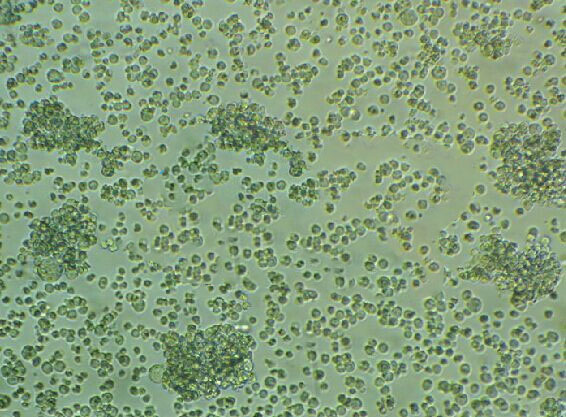 SU-DHL-5 Lymphoblastoid cells人弥漫大D细胞系,SU-DHL-5 Lymphoblastoid cells