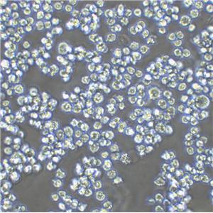 Hs 445 Lymphoblastoid cells人霍奇金淋巴瘤细胞系,Hs 445 Lymphoblastoid cells