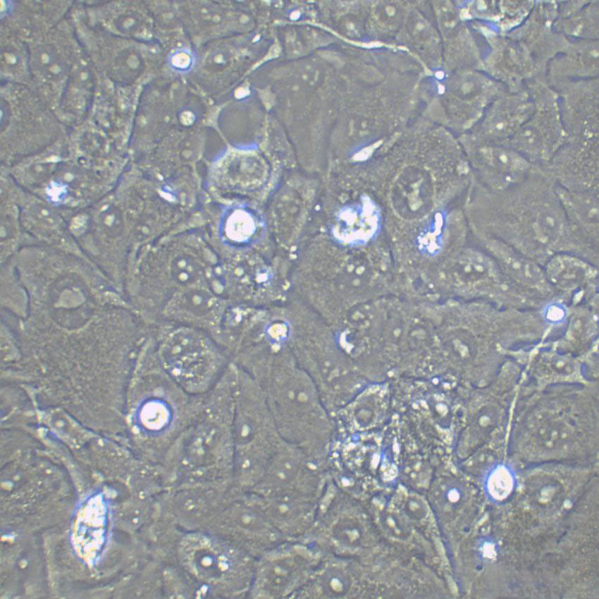 MFE-280 Adherent子宫内膜癌细胞系,MFE-280 Adherent