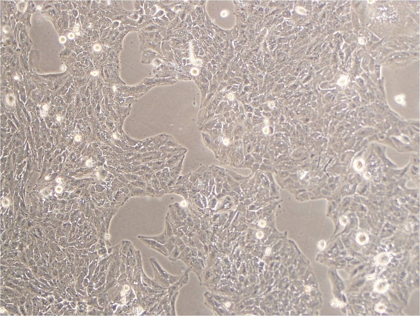 TKB-1 epithelioid cells人肺癌细胞系,TKB-1 epithelioid cells