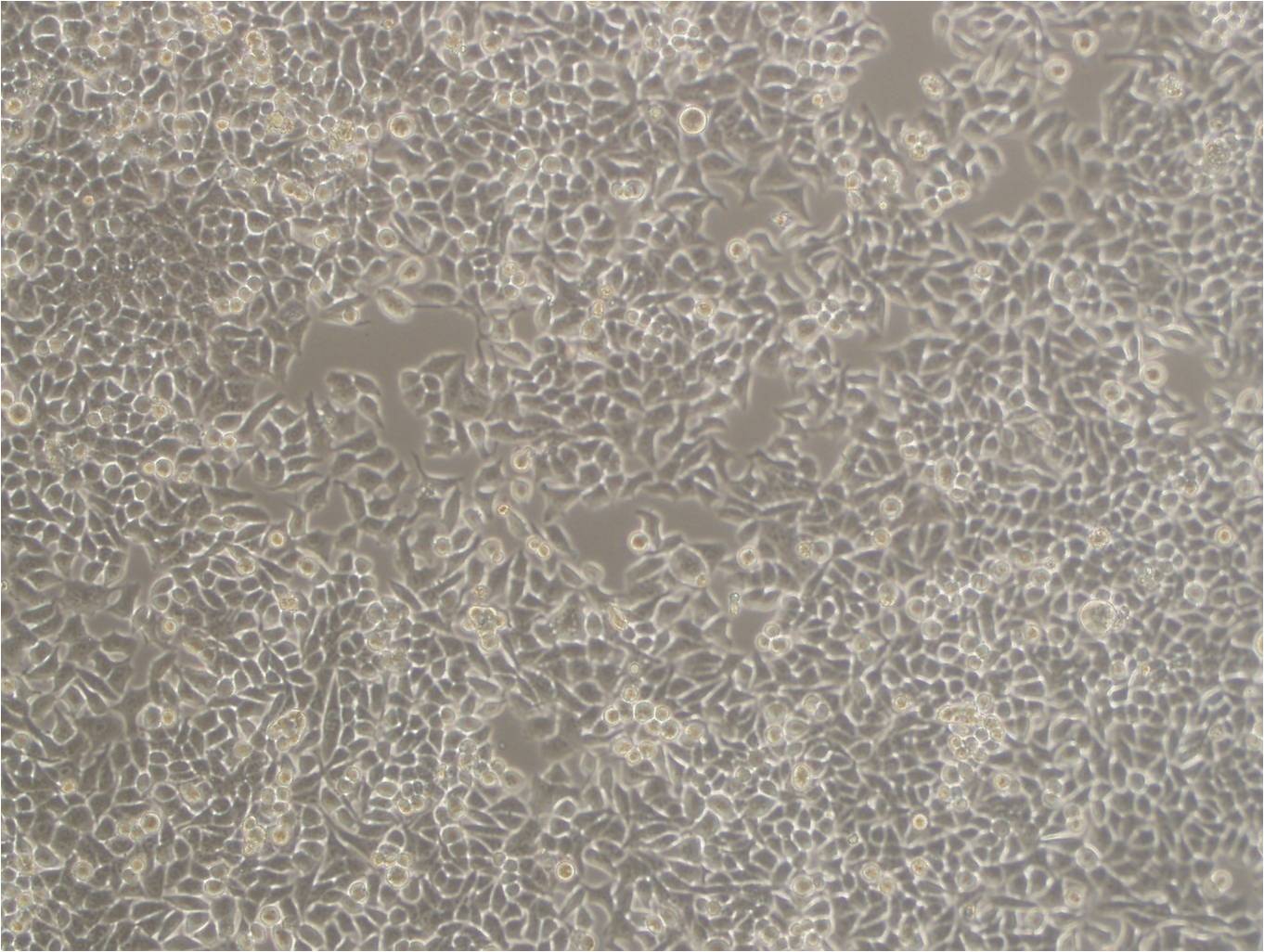 PG-LH7 epithelioid cells人肺癌低转移细胞系,PG-LH7 epithelioid cells