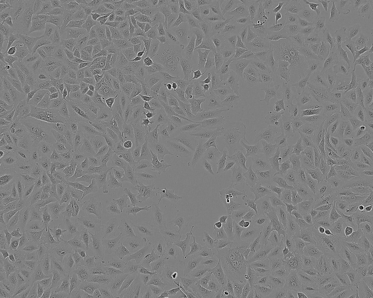 EBTr epithelioid cells牛胚气管细胞系,EBTr epithelioid cells