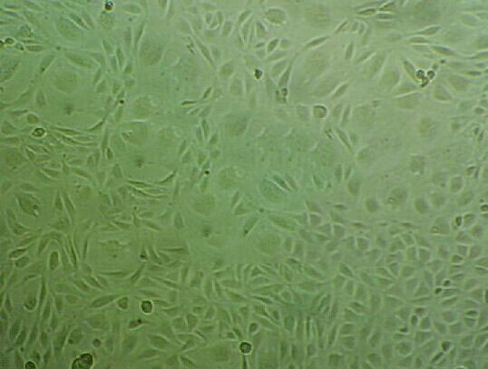 DoHH2 epithelioid cells人胸腔积液滤泡中心母细胞系,DoHH2 epithelioid cells