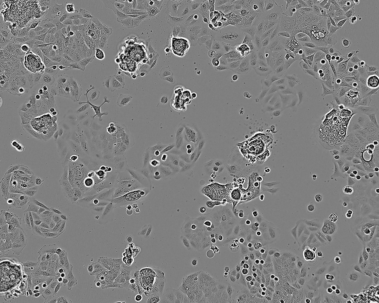 HEC-151 epithelioid cells人子宫内膜癌细胞系,HEC-151 epithelioid cells