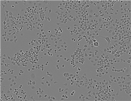 SNU-182 Adherent人肝癌细胞系