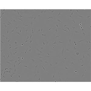 CHP-126 epithelioid cells人成神经细胞系