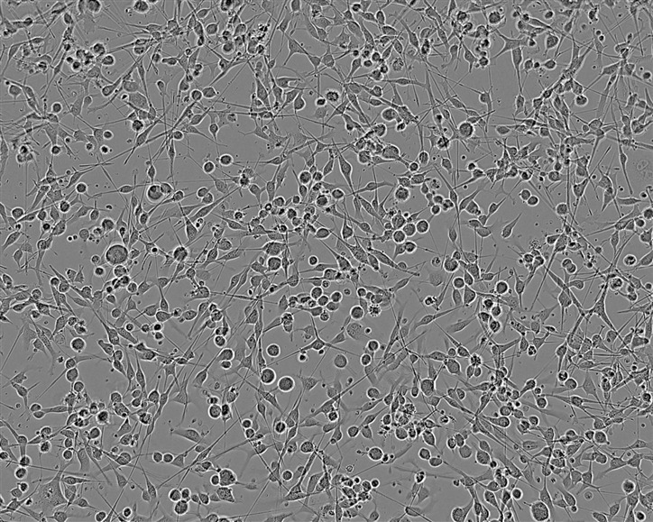 8305C Adherent人类甲状腺未分化癌细胞系,8305C Adherent