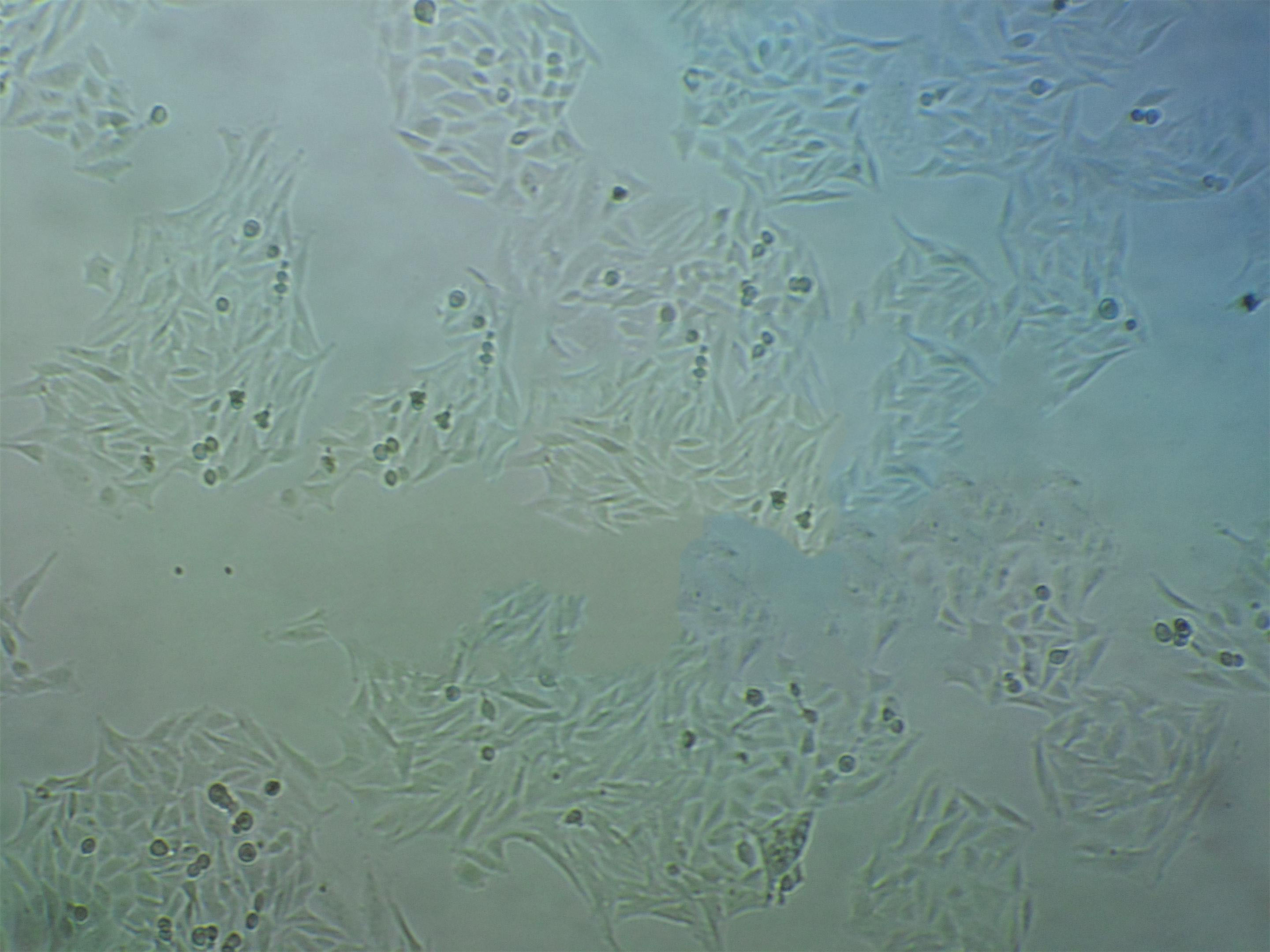 TGBC11TKB Adherent人胃癌细胞系,TGBC11TKB Adherent