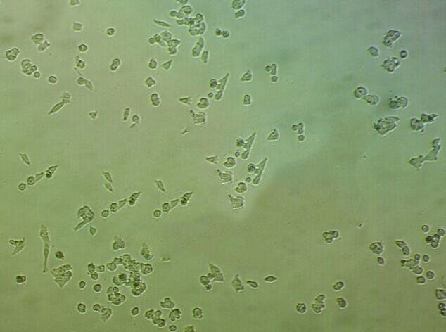 MX-1 Adherent人乳腺癌细胞系,MX-1 Adherent