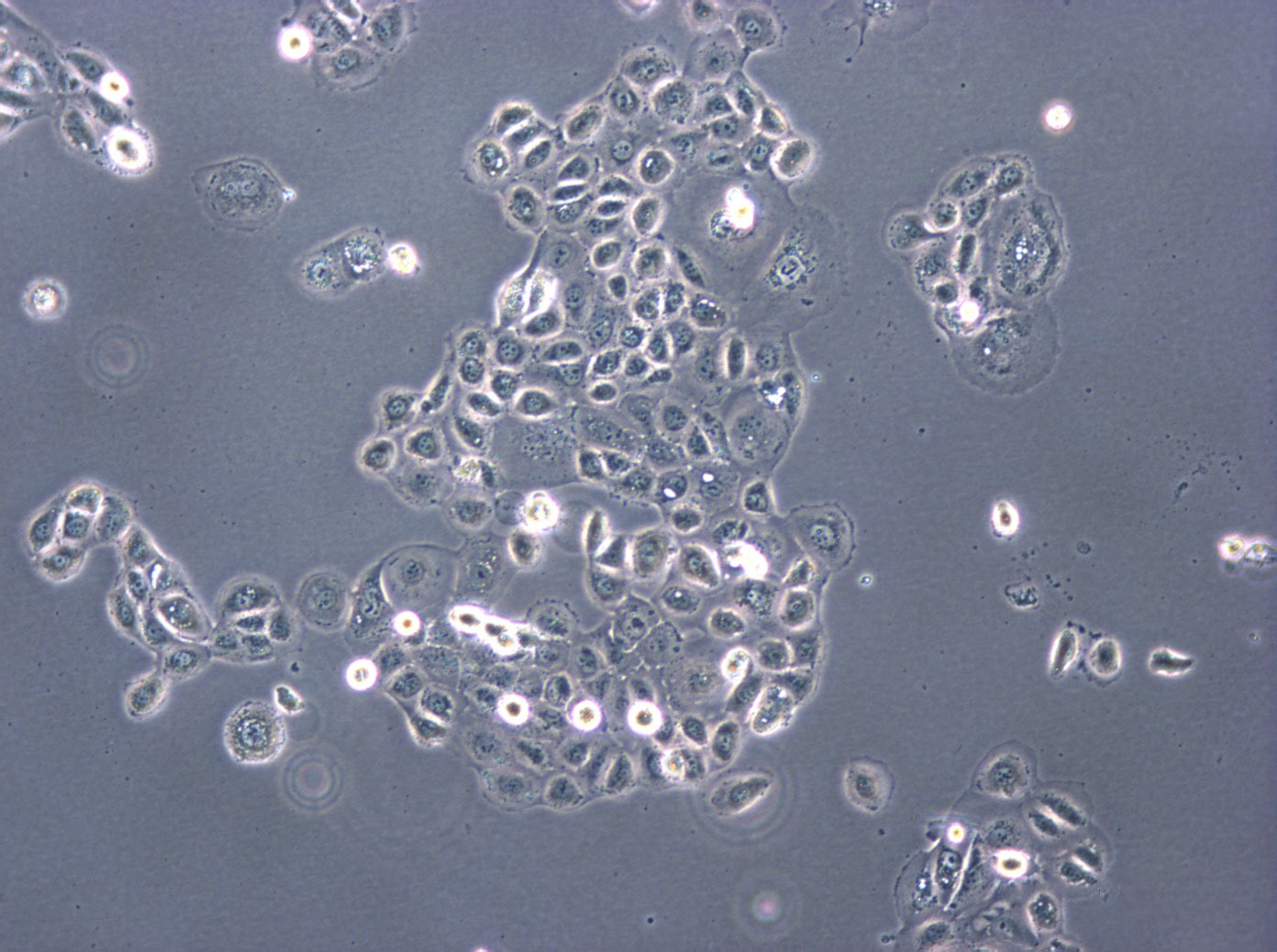 TE-6 Adherent人食管癌细胞系,TE-6 Adherent