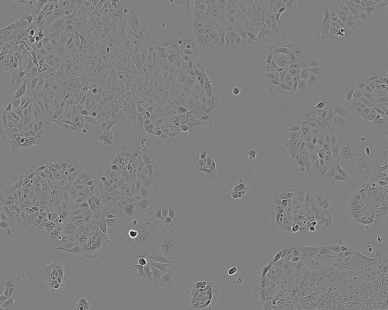 HRA-19 epithelioid cells人结肠癌腺癌细胞系,HRA-19 epithelioid cells