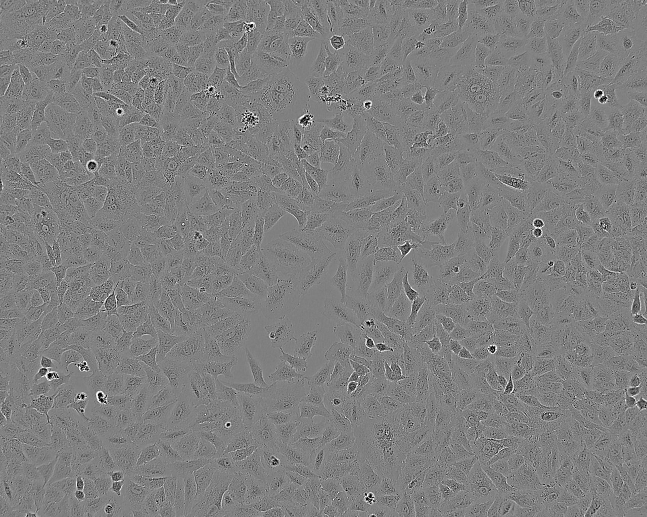 LCLC-103H epithelioid cells人肺癌细胞系,LCLC-103H epithelioid cells