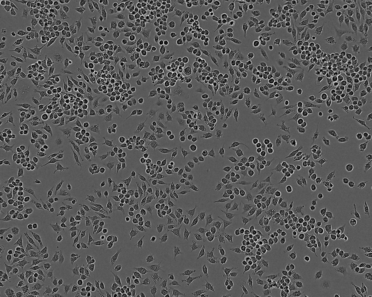LC-1/sq epithelioid cells人肺癌鳞癌细胞系,LC-1/sq epithelioid cells