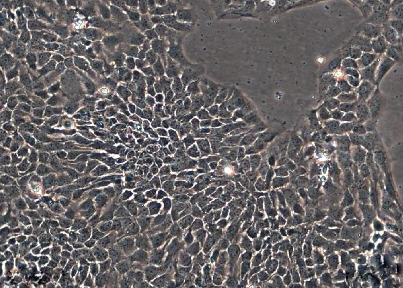 SNU-520 epithelioid cells人胃癌细胞系,SNU-520 epithelioid cells