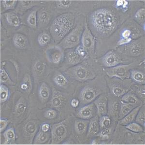 NCI-H1092 Adherent人小细胞肺癌细胞系