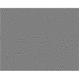 SK-UT-1 Adherent人子宫内膜癌细胞系