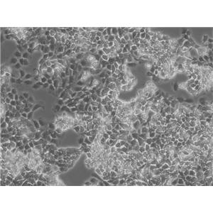 MES-SA/Dx5 Adherent人子宫肉瘤细胞系,MES-SA/Dx5 Adherent