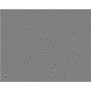 SN12C Adherent人宮頸癌細(xì)胞系,SN12C Adherent