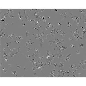 SUNE1 epithelioid cells人低分化鼻咽癌细胞系