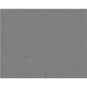 HRA-19 epithelioid cells人结肠癌腺癌细胞系