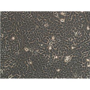 PAMC82 epithelioid cells人胃癌细胞系