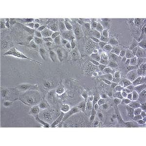 HCC1359 epithelioid cells人肺癌主轴巨细胞系