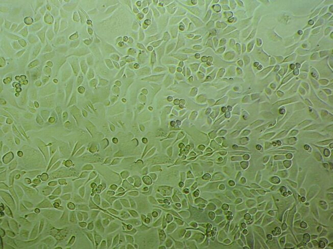 FHC Adherent人正常結(jié)直腸粘膜細胞系,FHC Adherent