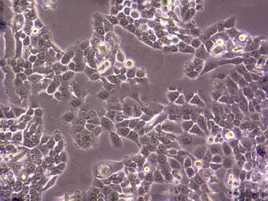 OVCAR-10 Adherent人卵巢癌细胞系,OVCAR-10 Adherent