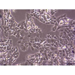 OVCAR-10 Adherent人卵巢癌细胞系