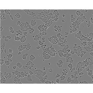 CHG-5 Adherent人恶性胶质瘤细胞系